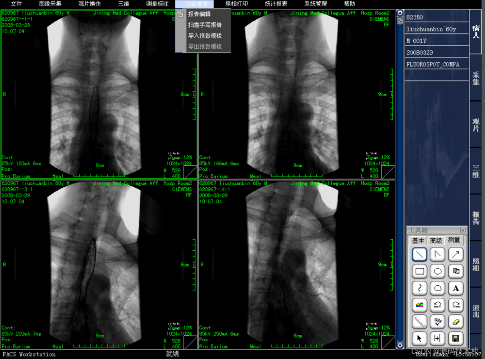 医院影像图像科室工作站PACS系统 DICOM 三维图像后处理与重建