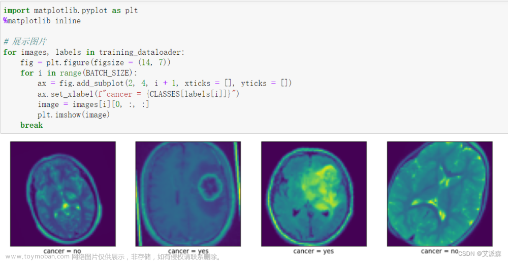 基于Pytorch深度学习的脑肿瘤分类识别（文末送书）,深度学习,python,数据挖掘,深度学习,人工智能