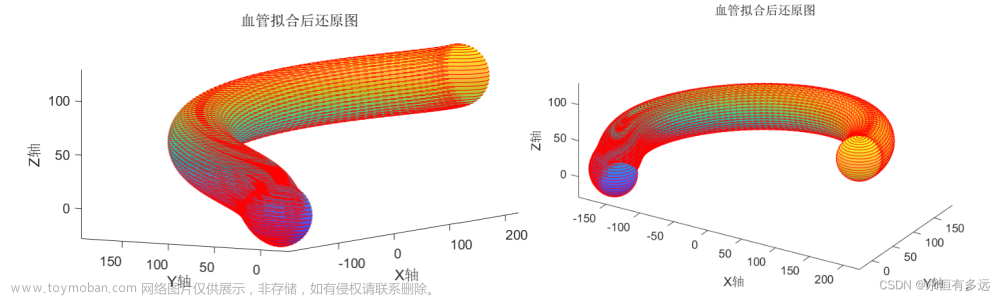 血管的三维重建数学建模,matlab,算法