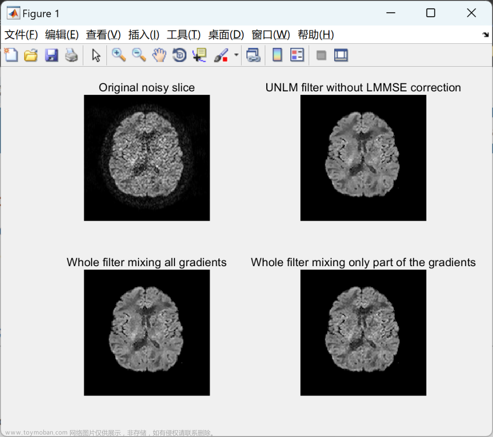 用于弥散加权MRI的关节各向异性维纳滤光片研究（Matlab代码实现）,matlab,计算机视觉,开发语言