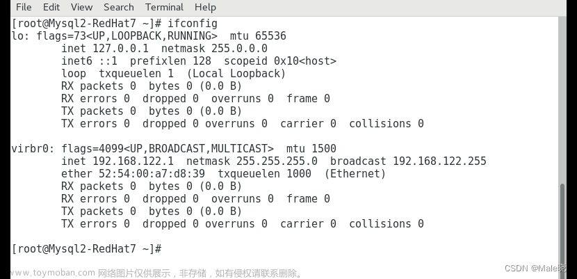 VM安装RedHat7虚机ens33网络不显示IP问题解决,网络,tcp/ip,服务器