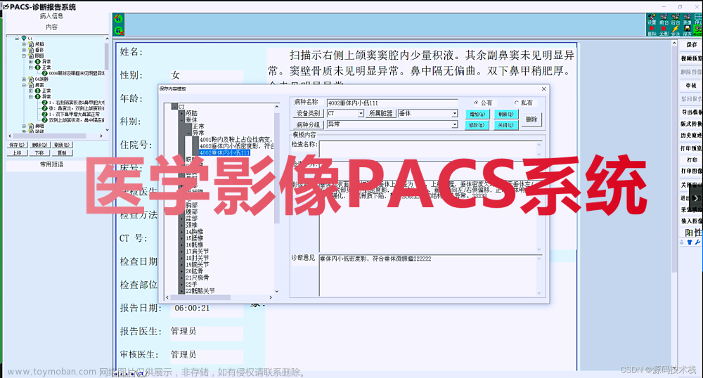 医院影像图像科室工作站PACS系统 DICOM 三维图像后处理与重建