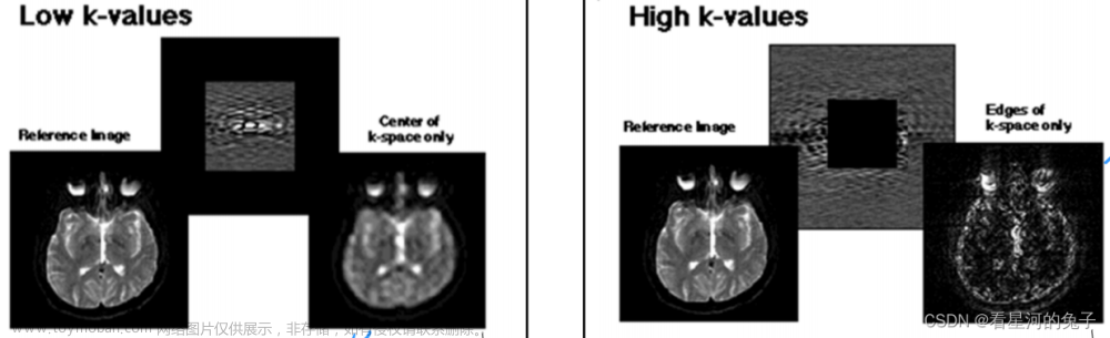 MRI k空间概念整理